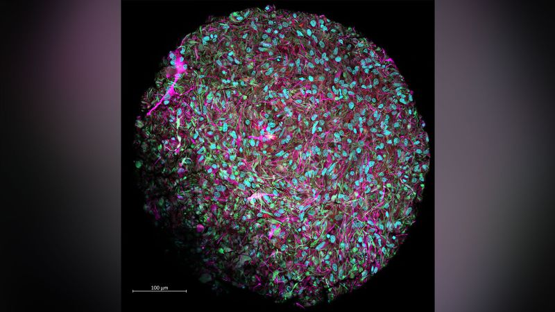 Human brain-powered computers could be the way of the future